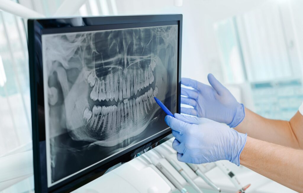 dental diagnosis radiology scaled